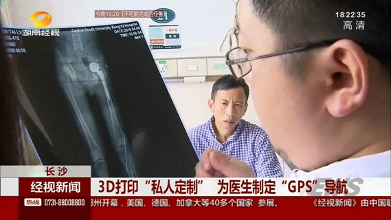 湘雅医院：3D打印“私人订制” 为医生制定“GPS”导航